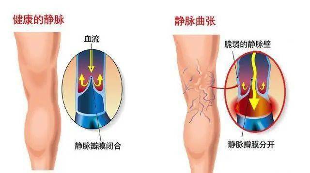 水分计与高压铝导线型号一样吗