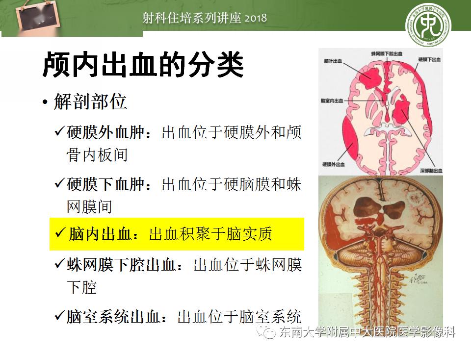 泪点低可能是大脑神经太发达精细化方案实施_MR84.58.78