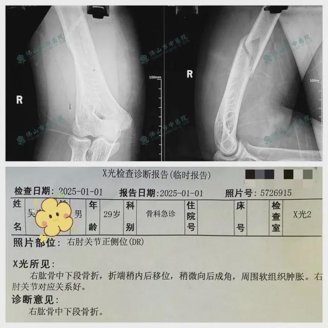 机器人扳手腕